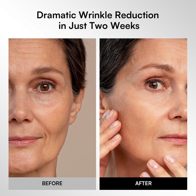 GLOW Wireless LED Face Mask,Portable and Rechargeable