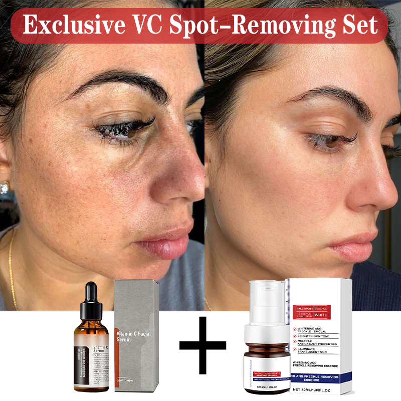 VC Spot-Removing Serum VC Whitening Freckles Face Cream (Set) – Yingtide