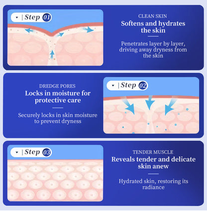 Crema con urea al 40 %: específica para hiperqueratosis, ictiosis, psoriasis y eczema 