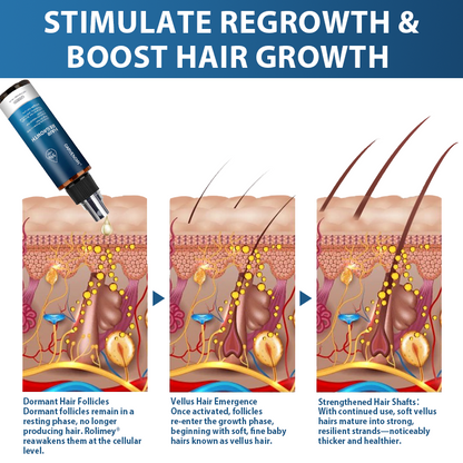 ✅🇺🇸 Developed by Trichologists：High-Concentration Minoxidil Hair Regrowth Serum