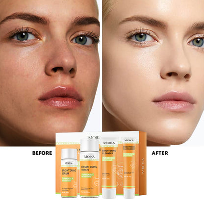 Turmeric + Nicotinamide Brightening Skincare Set - 4-Step Glow Solution