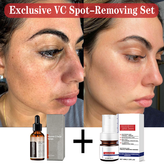 VC Spot-Removing Serum ✚ VC Whitening Freckles Face Cream (Set)