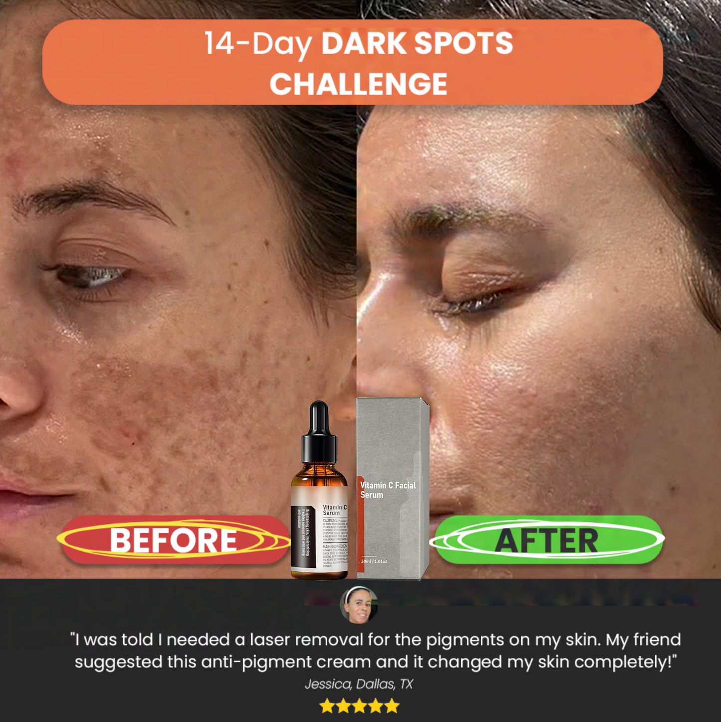 Vitamin C Spot-Removing Serum: Comprehensive Skin Improvement – Natural Anti-Aging Solution